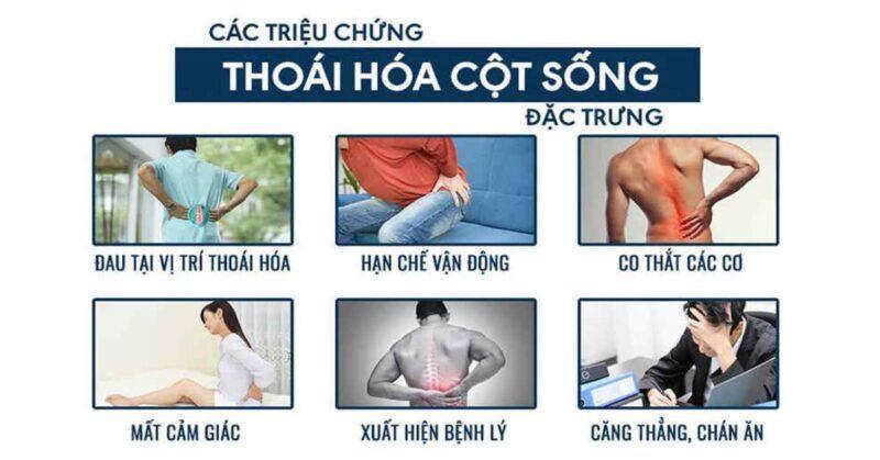 triệu chứng thoái hóa cột sống