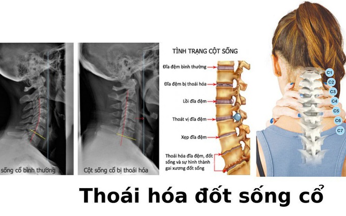 Thoai Hoa Dot Song Co.2