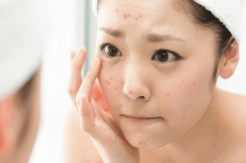 Skincare cho Da Dau