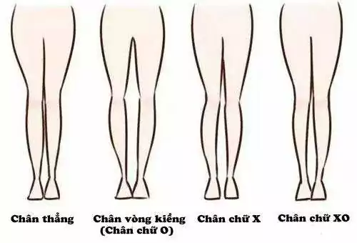 Chan Vong Kieng
