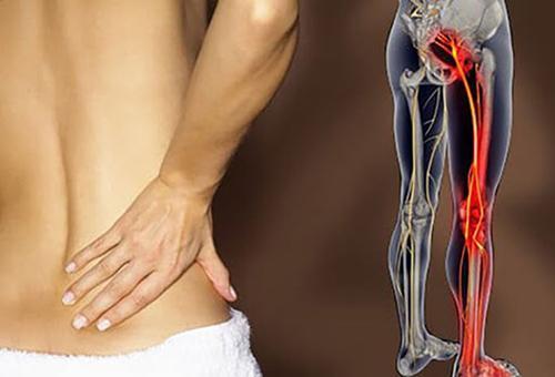 huyệt ủy trung điều trị các vấn đề đau nhức vùng lưng