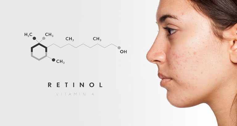 Retinol1