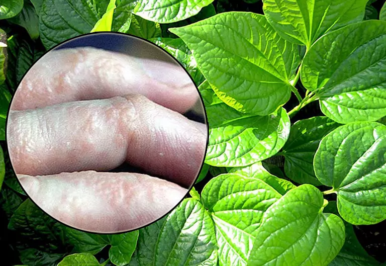 Cong Dung Cua La Lot