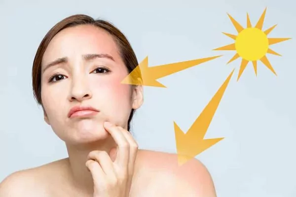 Đắp mặt nạ trứng gà có ăn nắng không?