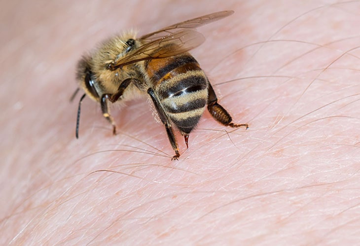 Ong đốt sẽ khiến da bạn sưng vài ngày hoặc vài tuần