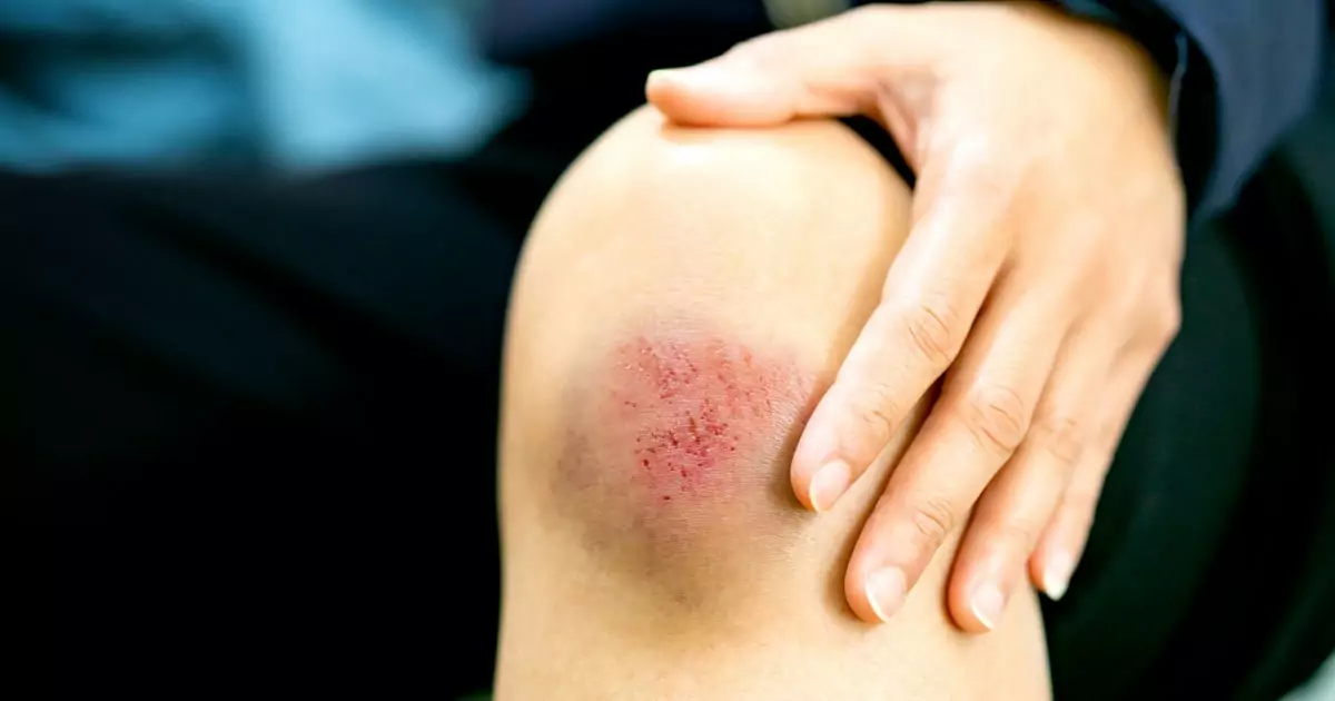 Sâm đại hành có tác dụng làm lành vết thương rất tốt