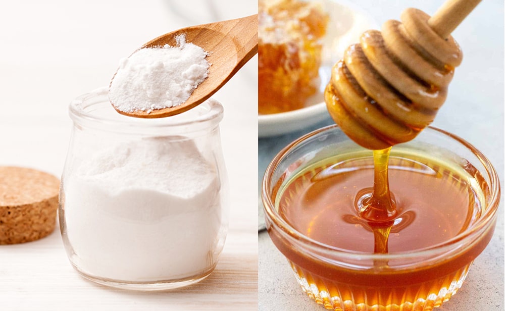 Cải thiện tình trạng mụn lưng đáng kể với baking soda và mật ong 