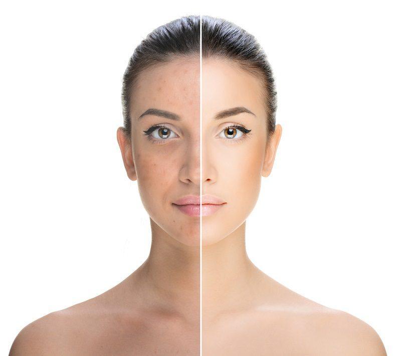 3 điểm chú ý về các sản phẩm máy massage mặt