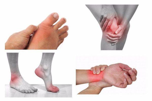 Cách điều trị đau nhức xương khớp tay chân