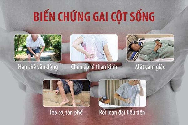 gai cot song lung 3