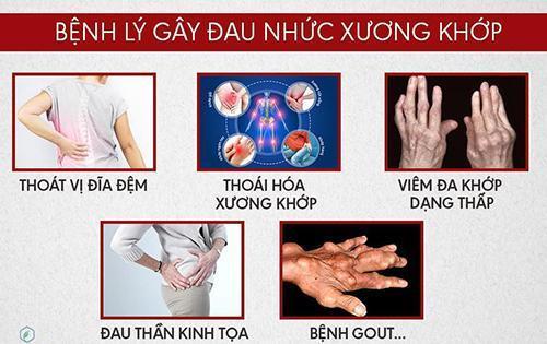 thói quen bẻ khớp là nguyên nhân gây ra những bệnh lý xương khớp