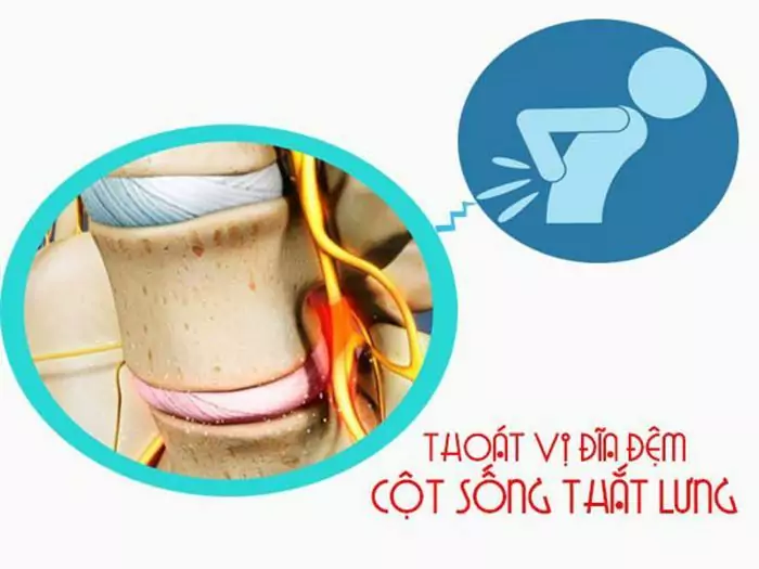 thoat vi dia dem that lung 2